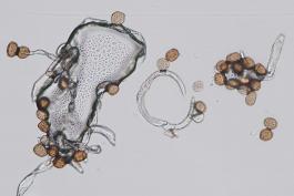 Microscopic view of cedar-apple rust aeciospores